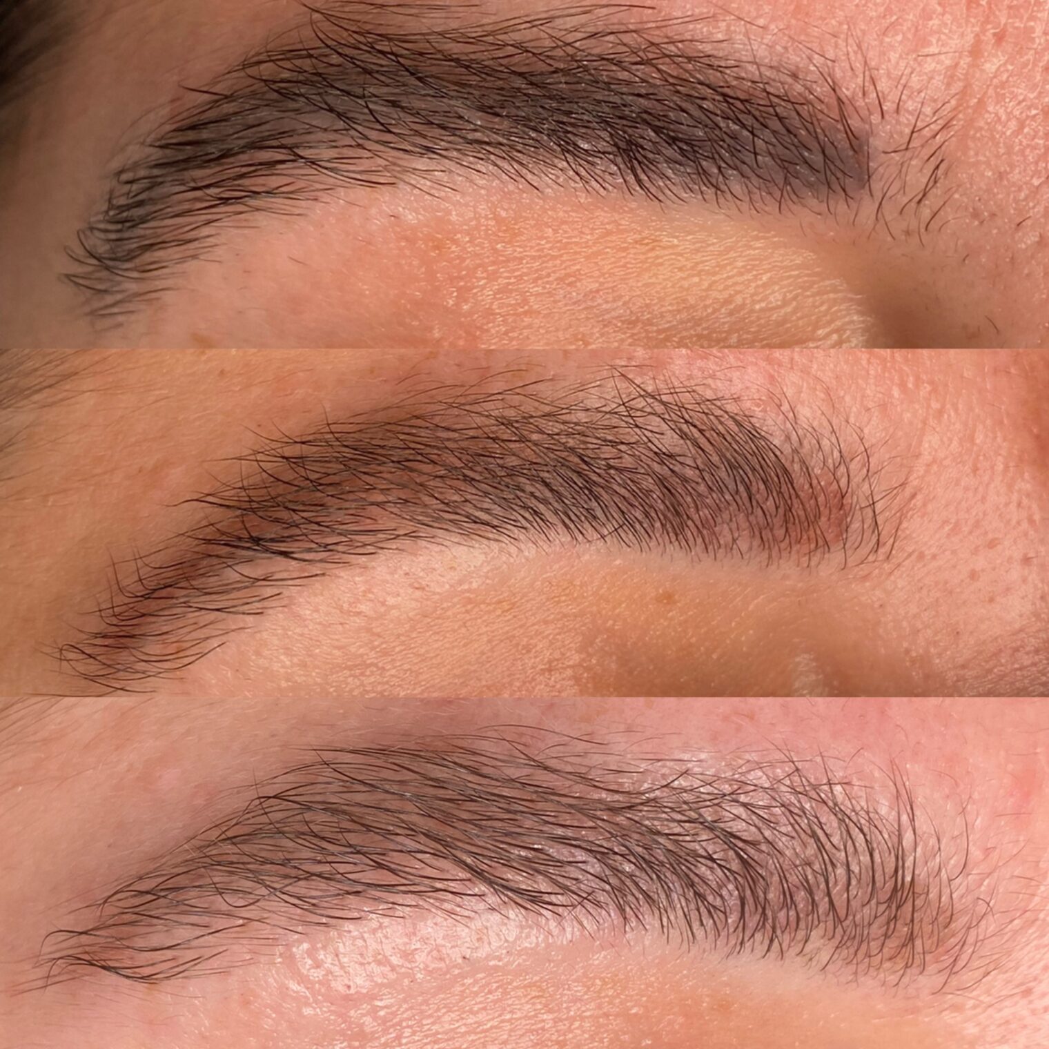 DETATOUAGE SOURCILS LUMIERE PULSEE BALLAINVILLIERS 91
