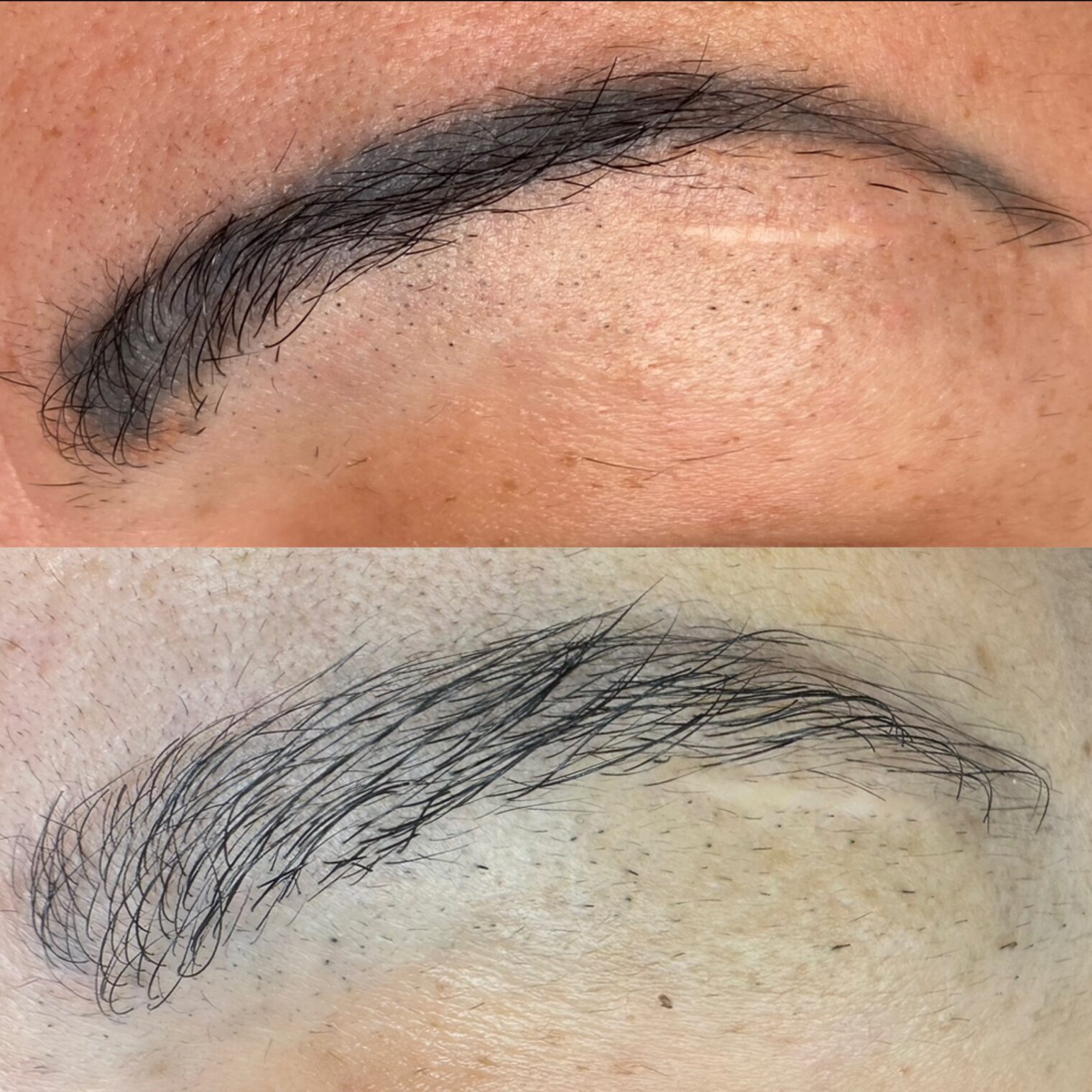 avant après détatouage sourcils noir dans l'Essonne