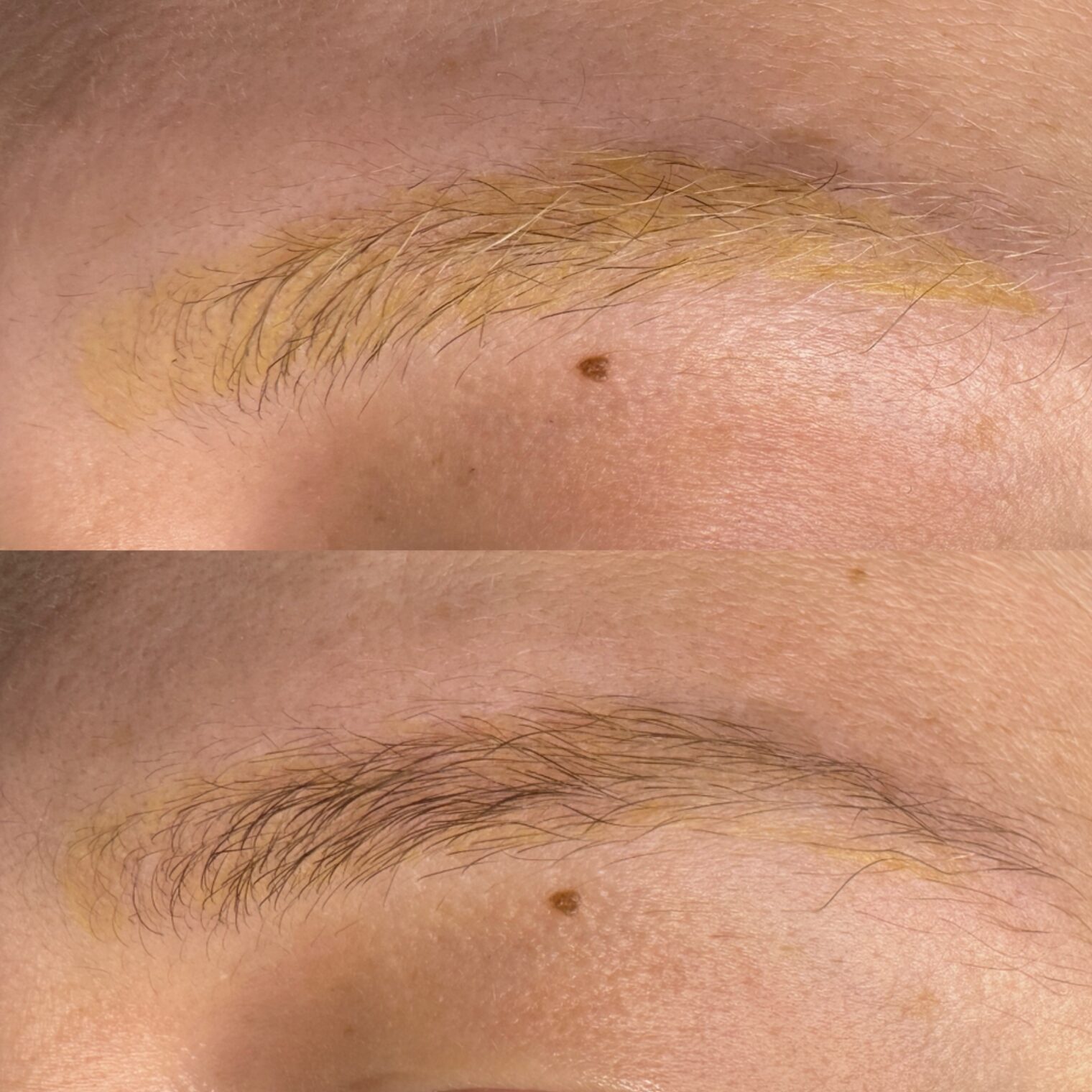 résultat détatouage sourcils jaune dans l'Essonne