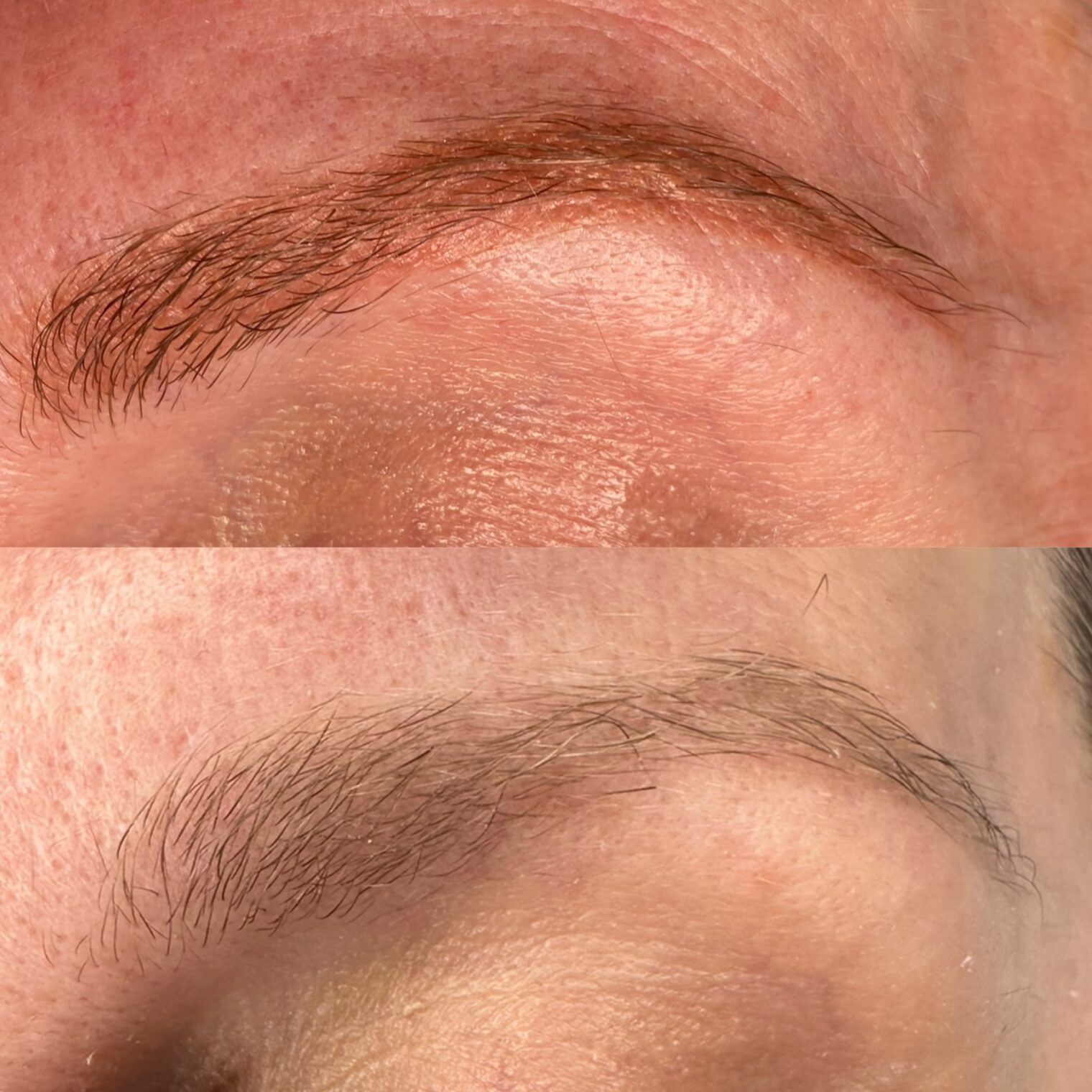 Détatouage sourcils rouges dans l'Essonne