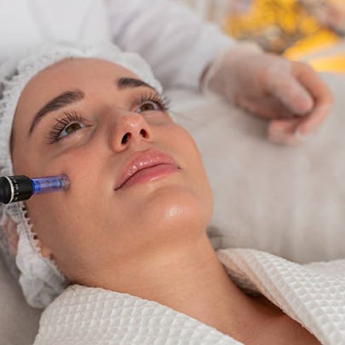 Caucasian woman girl undergoes facial rejuvenation using dermapen microneedling technique. Cosmetologist performs fractional mesotherapy procedure in beauty clinic to improve skin texture and health